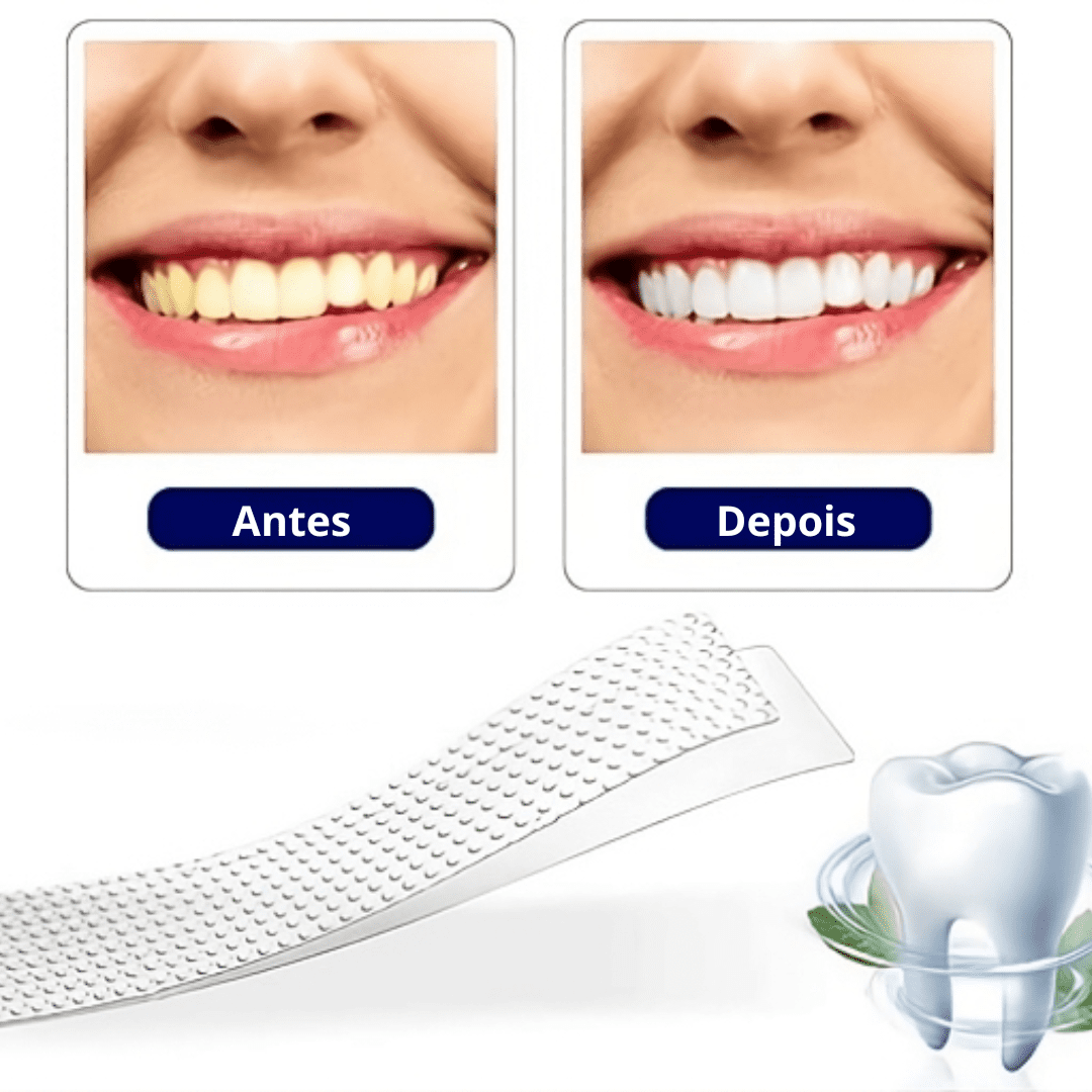 Sorrisus White® Adesivo Dental 5D